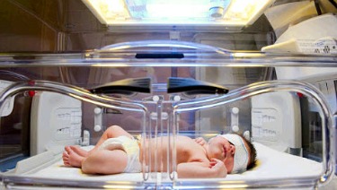 jaundice lights