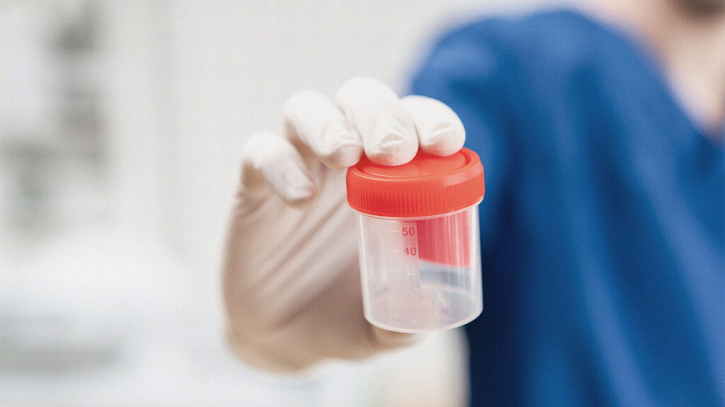 O médico segura um recipiente de amostra de esperma.