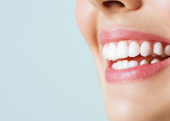clareamento-dental