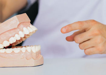 protese-dentaria
